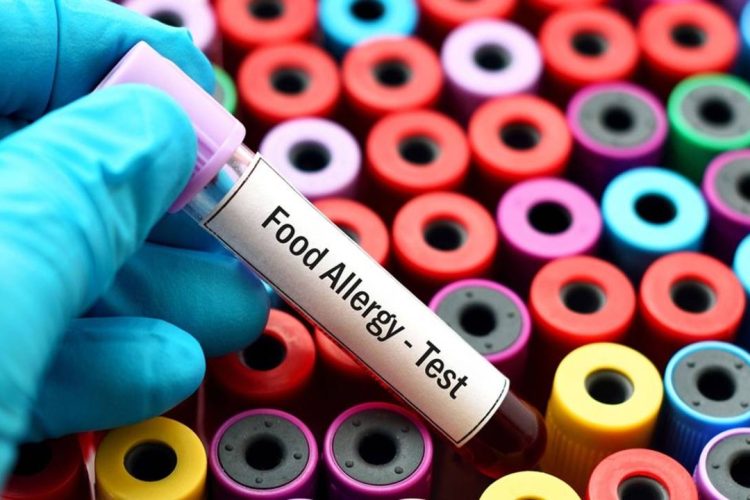 6610a07968ed6a0d3dfb8250_J6YO5lwRcqvq2bD9CZQg_Food-Allergy-Testing
