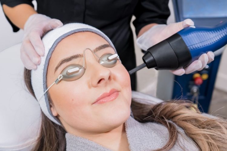 frakcjonowanie-laserowe